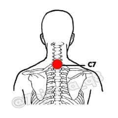 الحجامة هدية من رب العالمين للإنسانية جمعاء الحجامة هدية من رب العالمين للإنسانية جمعاء