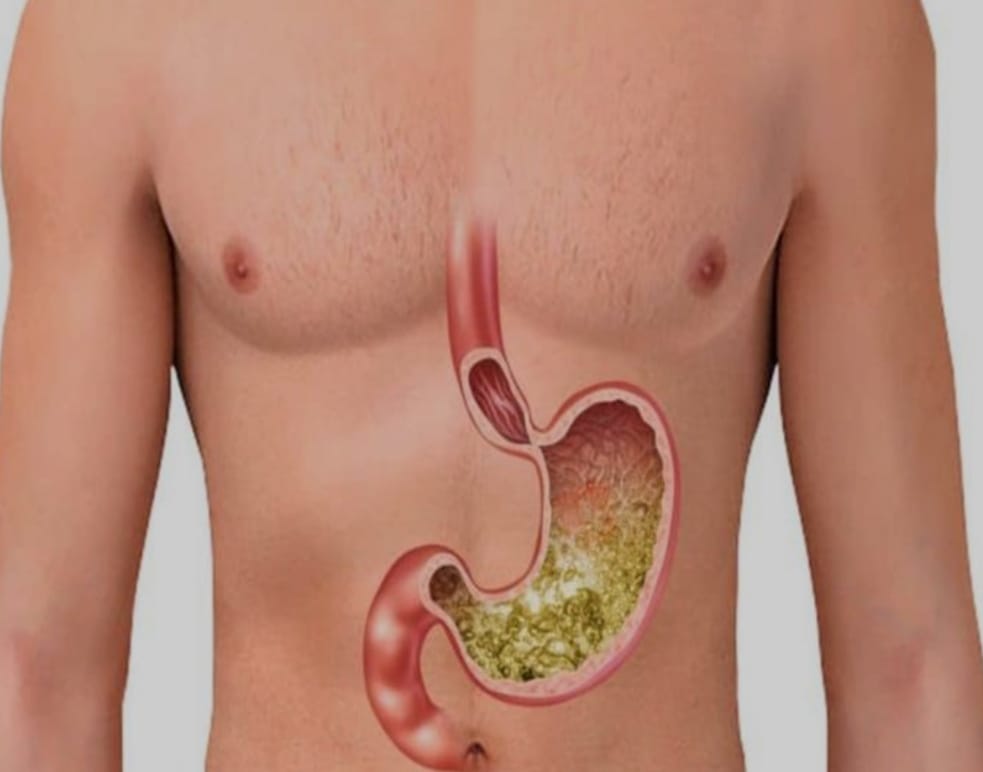 مركز أبا الهيثم للعلاجات الطبيعية مكناس المغرب .. لتنظيف المعدة والجهاز الهضمي .. مركز أبا الهيثم للعلاجات الطبيعية مكناس المغرب .. لتنظيف المعدة والجهاز الهضمي ..