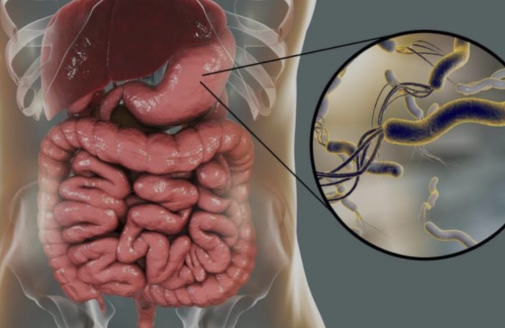 مركز أبا الهيثم للعلاجات الطبيعية مكناس المغرب .. لتنظيف المعدة والجهاز الهضمي .. مركز أبا الهيثم للعلاجات الطبيعية مكناس المغرب .. لتنظيف المعدة والجهاز الهضمي ..