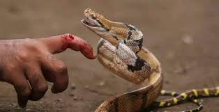 لدغة أفعى تُرسل شابًا من دوار إعشيران إلى قسم الإنعاش لدغة أفعى تُرسل شابًا من دوار إعشيران إلى قسم الإنعاش