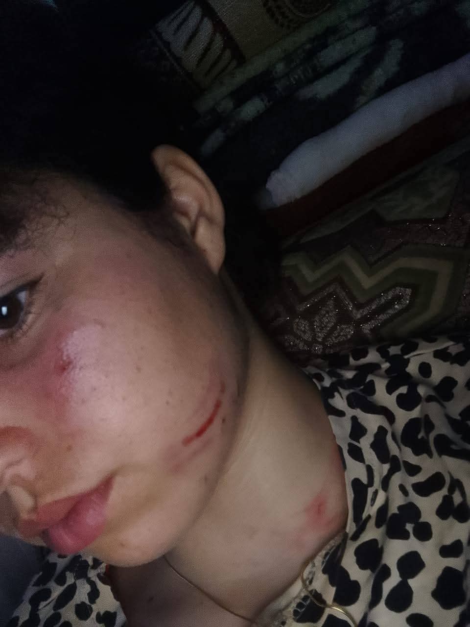اعتداء شنيع على تلميذة قاصر داخل إعدادية مولاي رشيد بتازة يثير موجة استياء واسعة. اعتداء شنيع على تلميذة قاصر داخل إعدادية مولاي رشيد بتازة يثير موجة استياء واسعة.