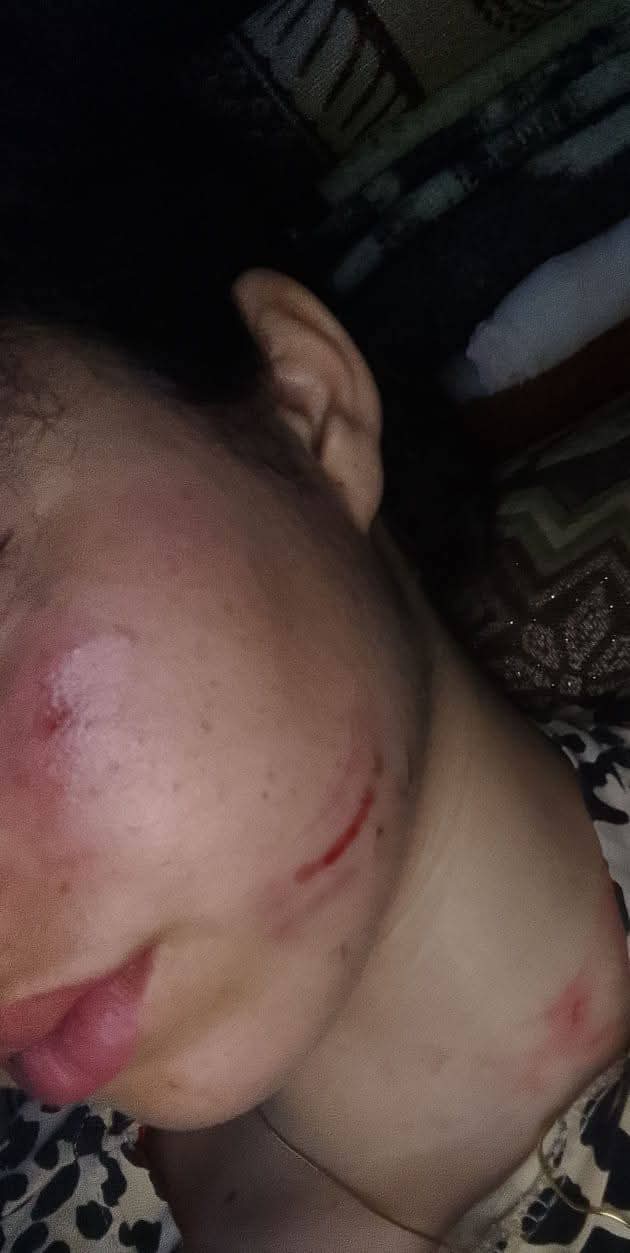 اعتداء شنيع على تلميذة قاصر داخل إعدادية مولاي رشيد بتازة يثير موجة استياء واسعة. اعتداء شنيع على تلميذة قاصر داخل إعدادية مولاي رشيد بتازة يثير موجة استياء واسعة.